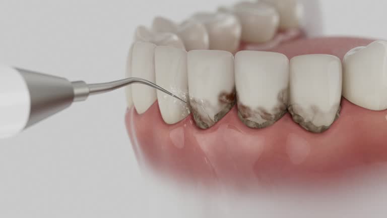 Trusted Teeth Cleaning And Checkup service in Alamo Heights, TX - Dentist Open Now